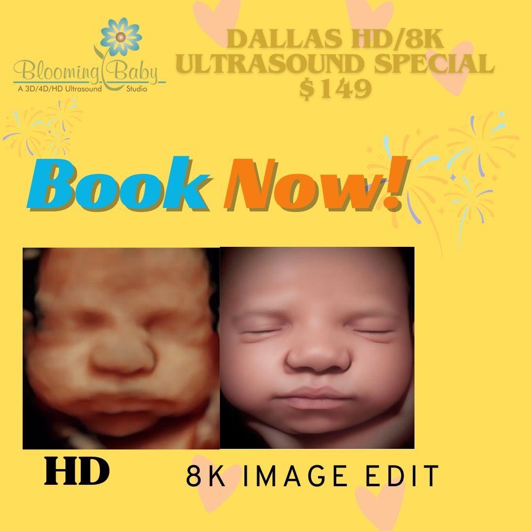 Dallas HD 8k promo