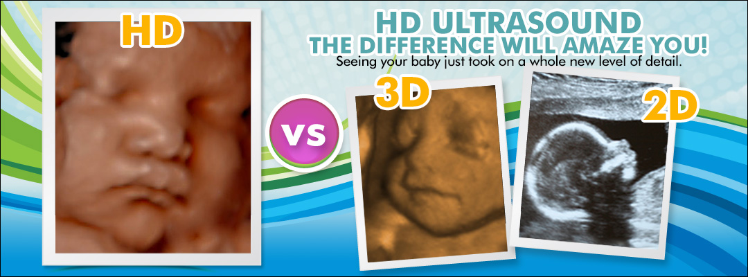 HD ultrasound Dallas